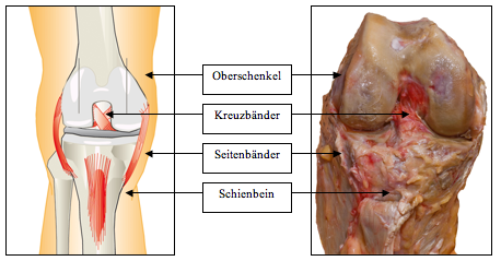 AG Endoprothetik Darstellung Knie
