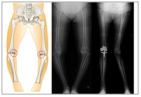 AG Endoprothetik Darstellung Knie